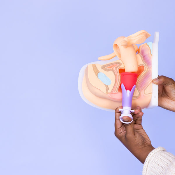 Load image into Gallery viewer, Cup Applicator