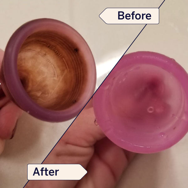 Stain Remover